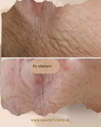 Výživa a ani-agening